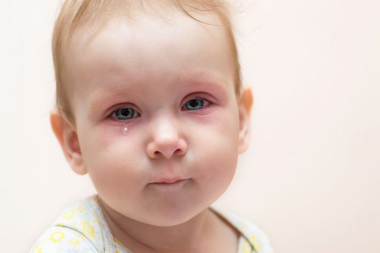 A mi bebé le llora mucho un ojo ¿Tendrá el lacrimal obstruido?